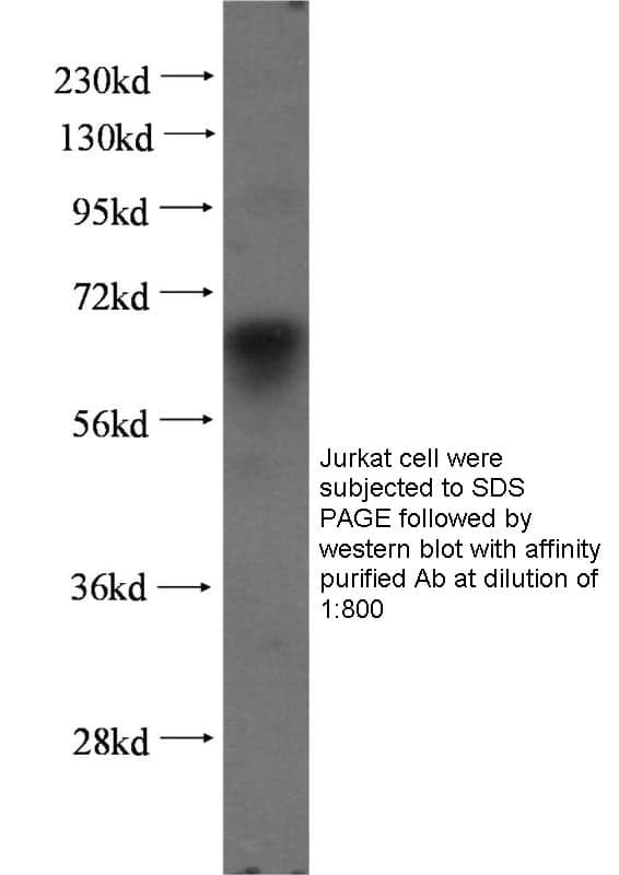 Anti Human GPC3 Polyclonal
