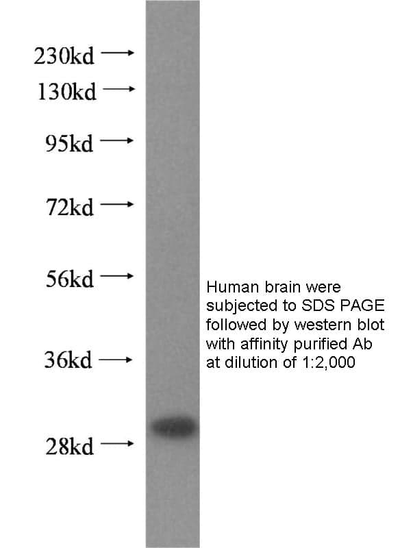 Anti Human EIF4E Polyclonal