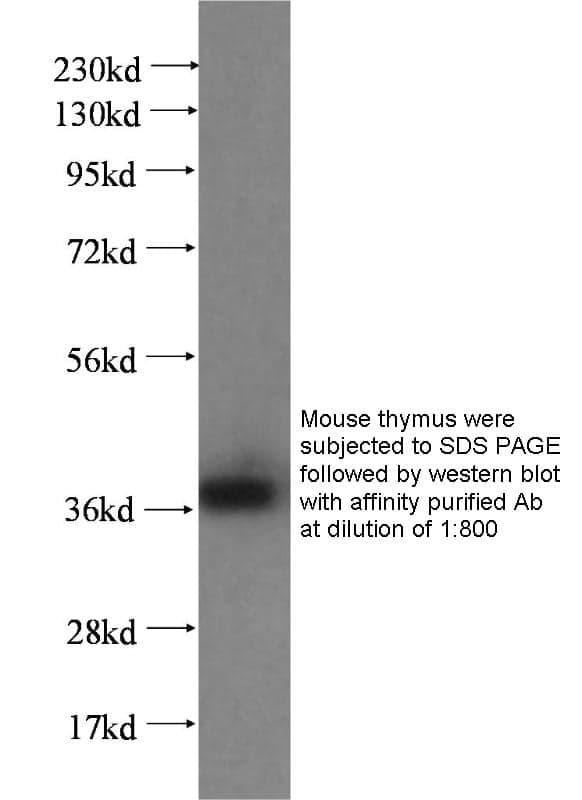 Anti Human FLCN Polyclonal