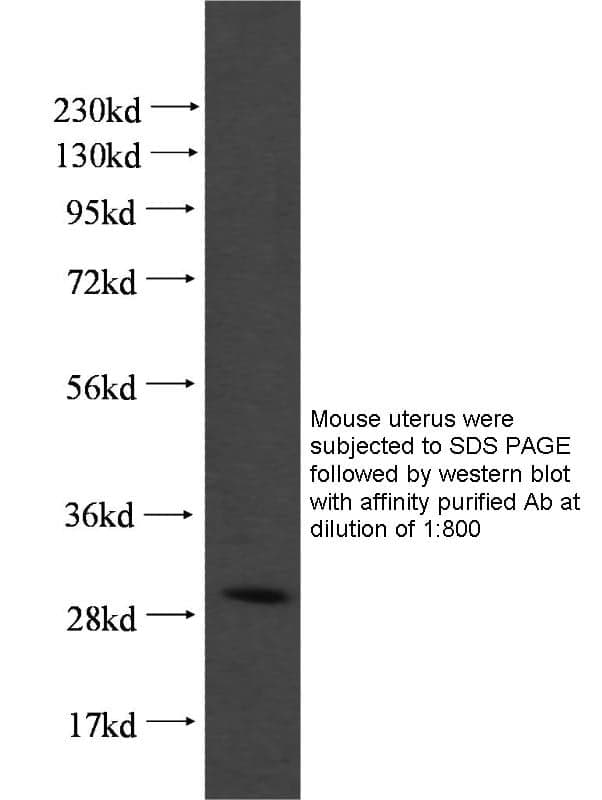 Anti Human CTSK Polyclonal
