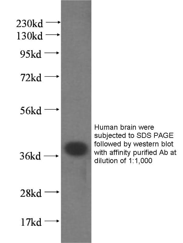 Anti Human RAD51AP1 Polyclonal