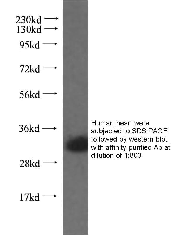 Anti Human HAX1 Polyclonal