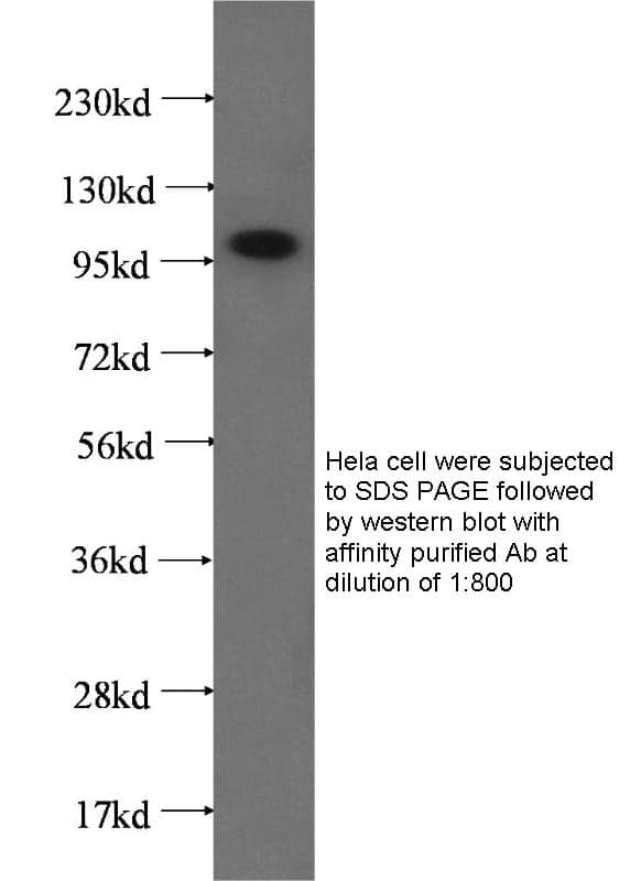 Anti Human XRN2 Polyclonal