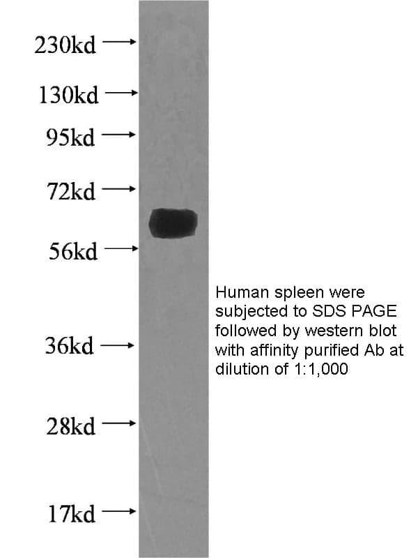 Anti Human SLC29A1 Polyclonal