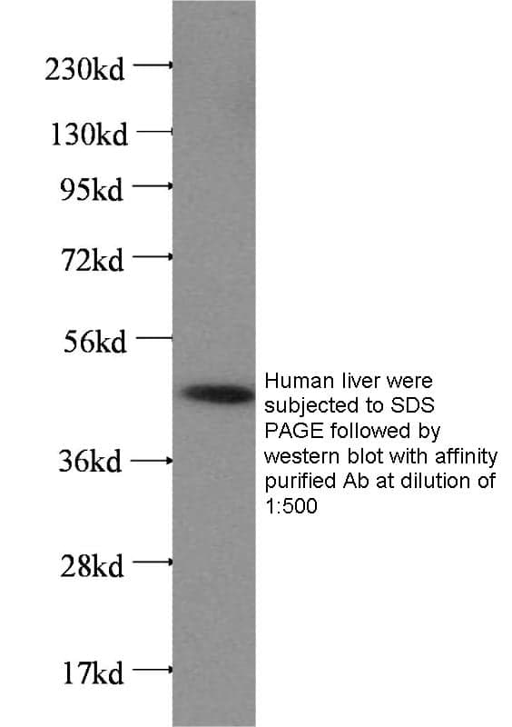 Anti Human FH Polyclonal