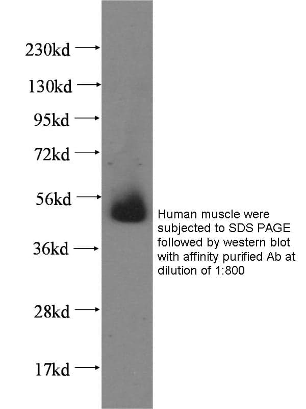 Anti Human CRBN Polyclonal