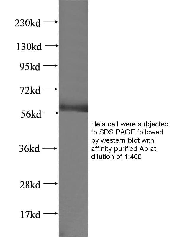 Anti Human PRAME Polyclonal