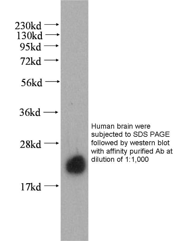 Anti Human COX4I2 Polyclonal