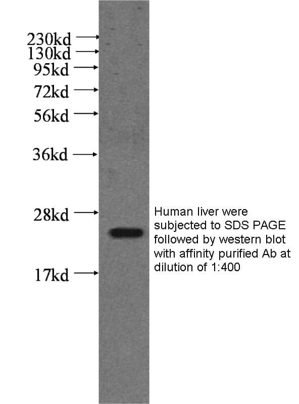 Anti Human PTPMT1 Polyclonal
