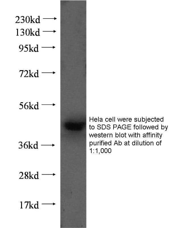 Anti Human FNTB Polyclonal