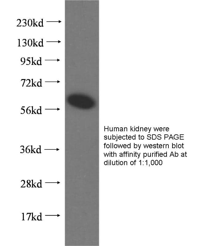 Anti Human GTPBP2 Polyclonal