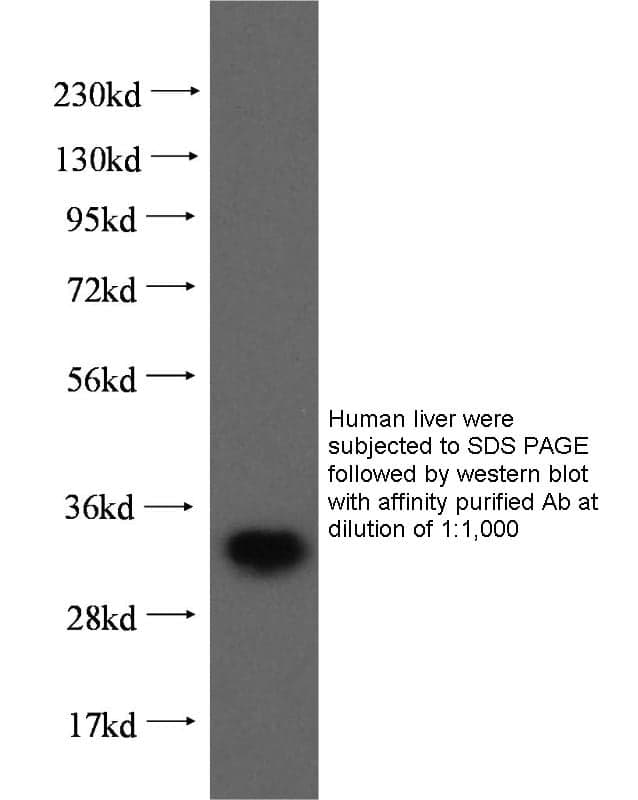 Anti Human ING2 Polyclonal