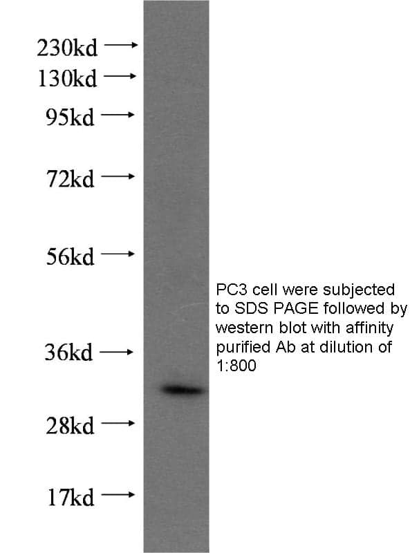 Anti Human SIX2 Polyclonal