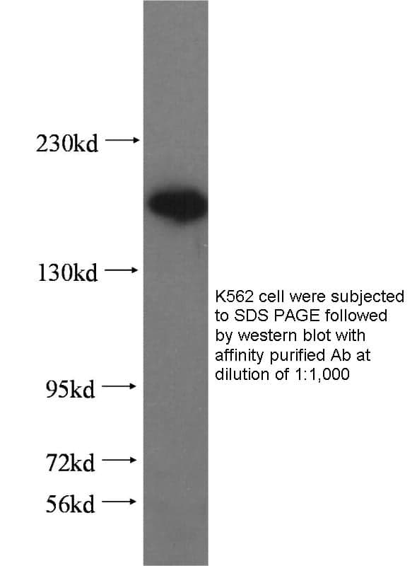 Anti Human VprBP Polyclonal