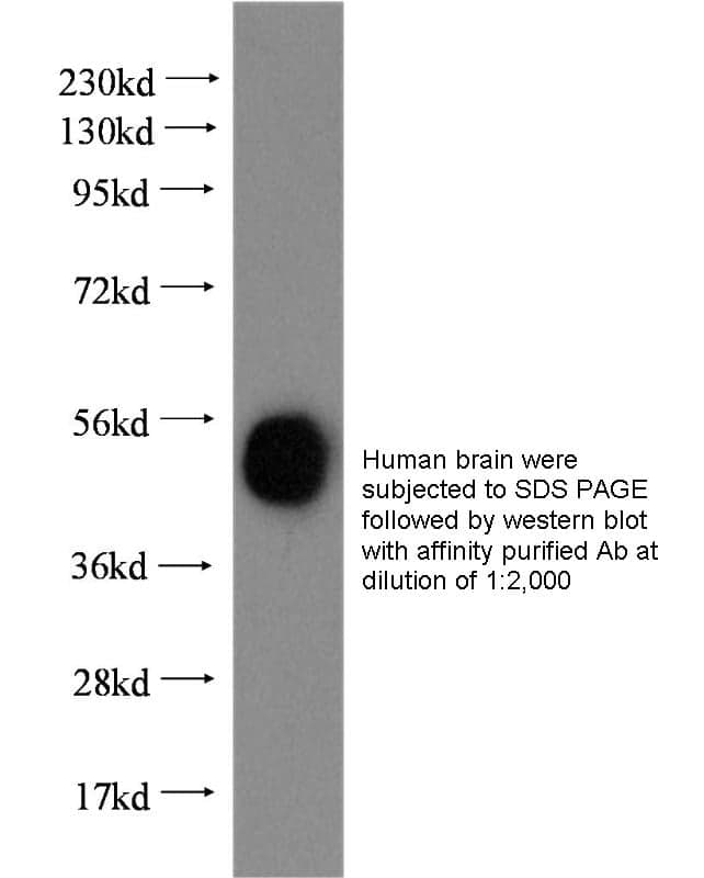 Anti Human ERRFI1 Polyclonal