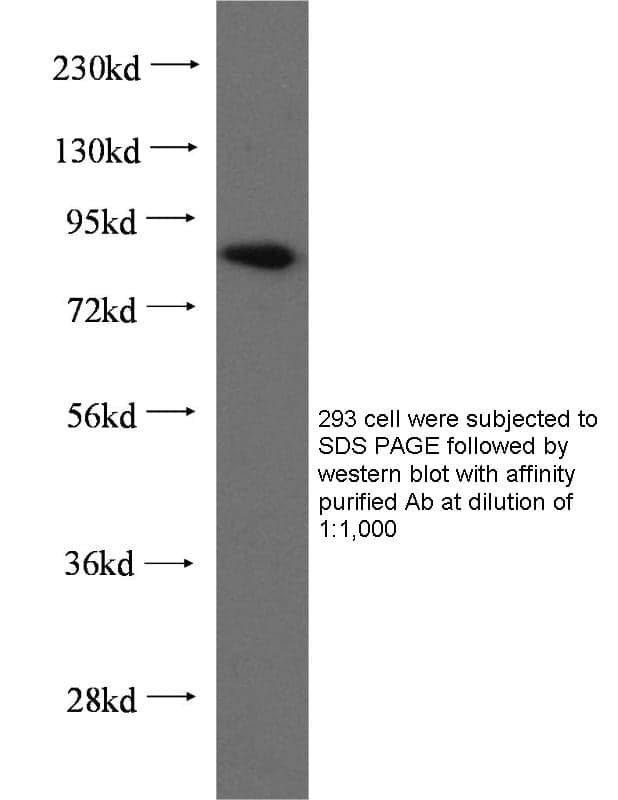 Anti Human MLH1 Polyclonal