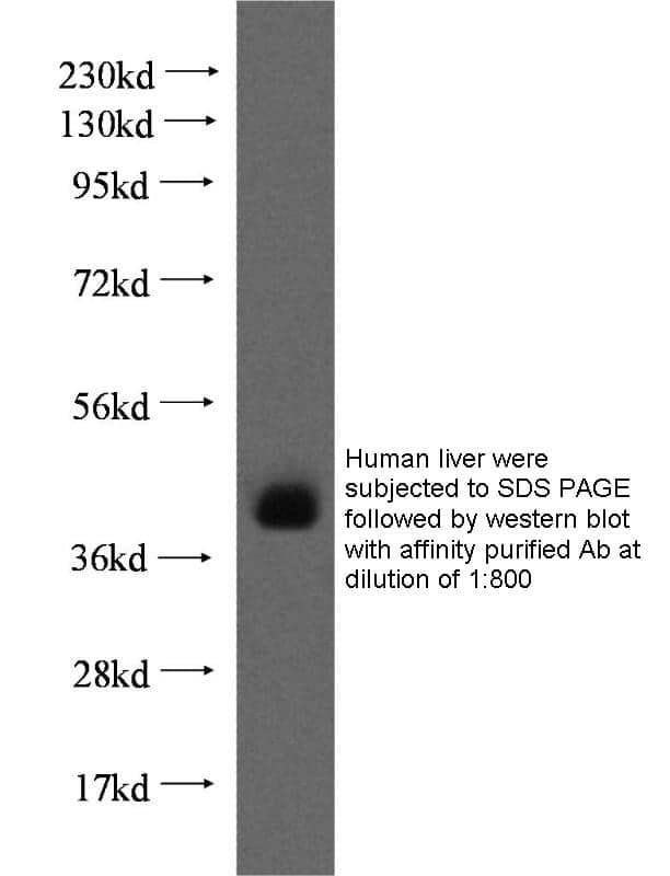 Anti Human TPST2 Polyclonal