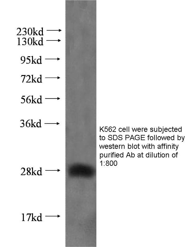 Anti Human LIN28 Polyclonal