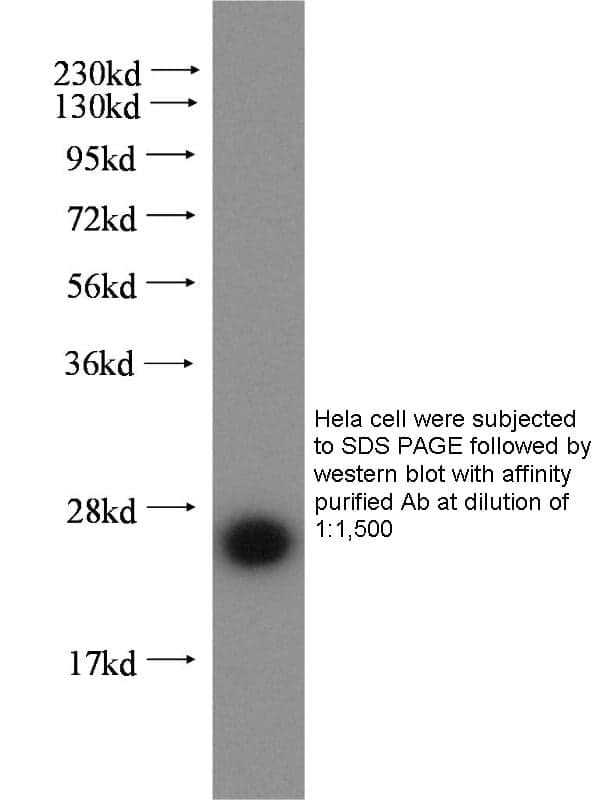 Anti Human RAB2B Polyclonal