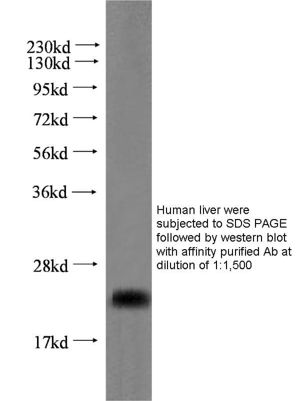 Anti Human RBP4 Polyclonal