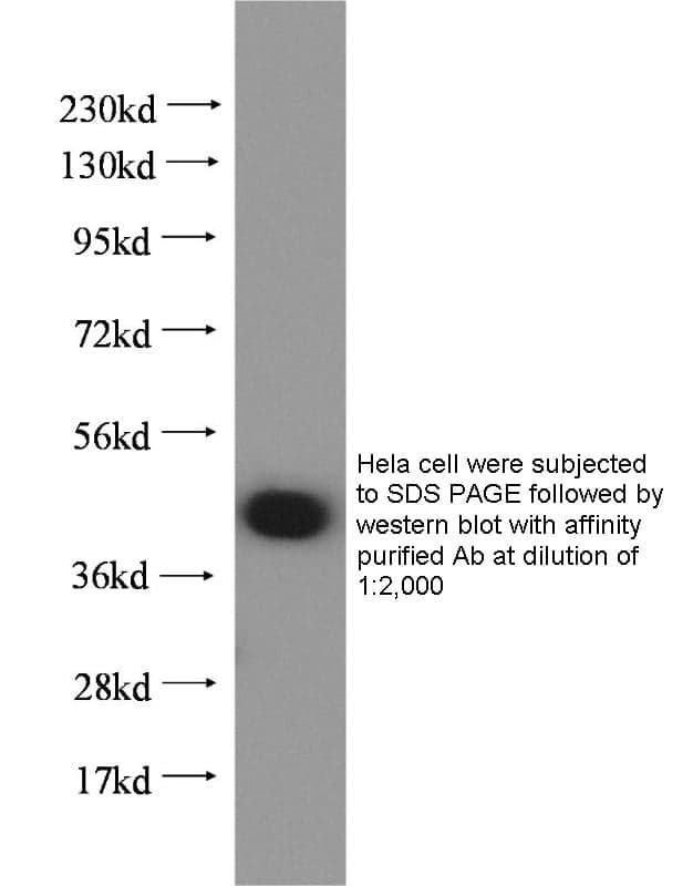 Anti Human RASSF6 Polyclonal