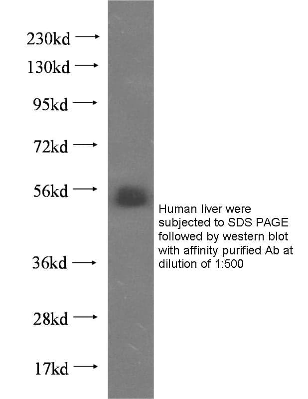 Anti Human AGT Poly