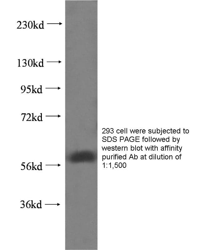 Anti Human CBG Poly