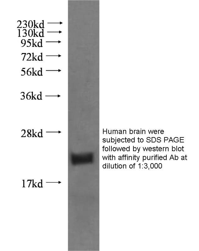 Anti Human Bax Polyclonal