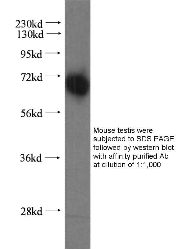 Anti Mouse CD2AP Polyclonal