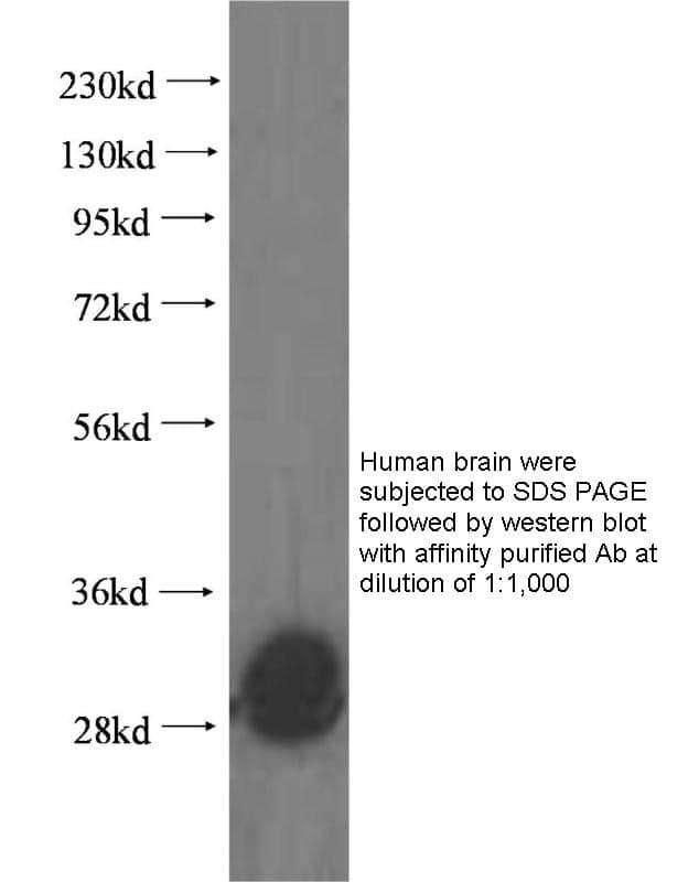 Anti Human GALC Polyclonal