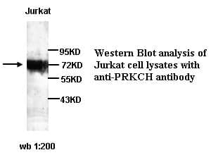 Anti-PRKCH