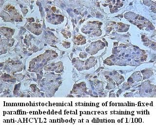 Anti-AHCYL2