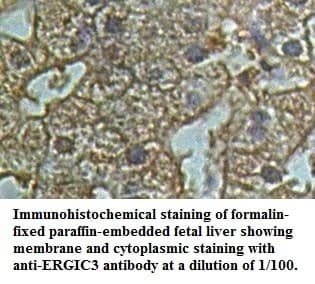Anti-ERGIC3