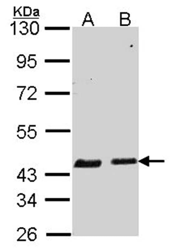 Anti-SERPINB6