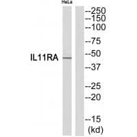 Anti-IL11RA
