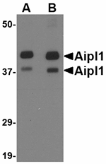Anti-AIPL1