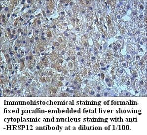 Anti-HRSP12
