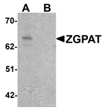 Anti-ZGPAT
