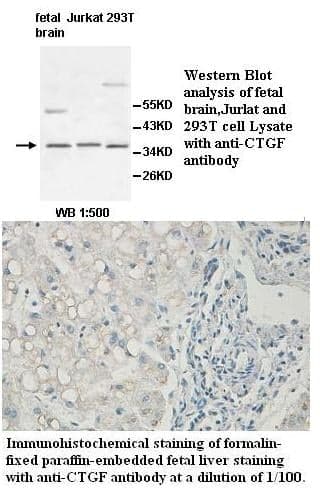 Anti-CTGF