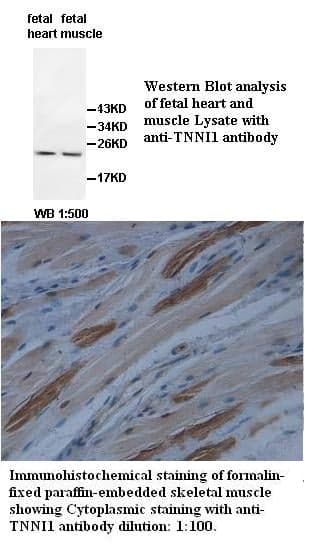 Anti-TNNI1