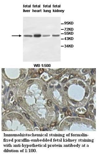 Anti-hypothetical protein