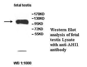 Anti-AHI1