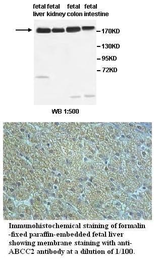 Anti-ABCC2