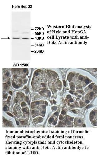 Anti-Beta Actin