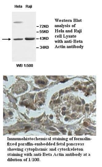 Anti-Beta Actin