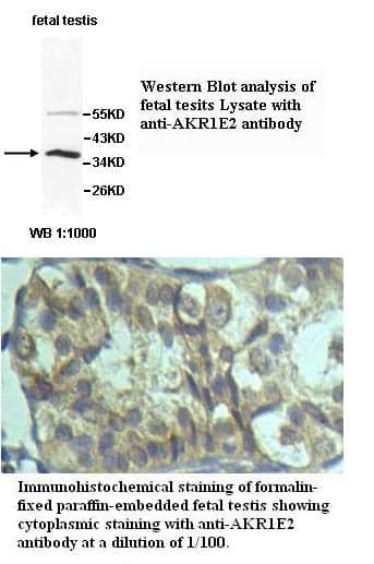 Anti-AKR1E2