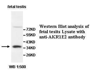 Anti-AKR1E2