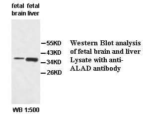 Anti-ALAD