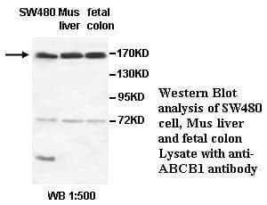 Anti-ABCB1