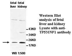 Anti-TP53INP1